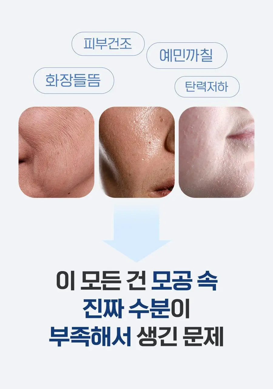 [모공/수분] 메디필 히알루론산 레이어 물톡스 크림 50g 더블 기획 상세페이지 9